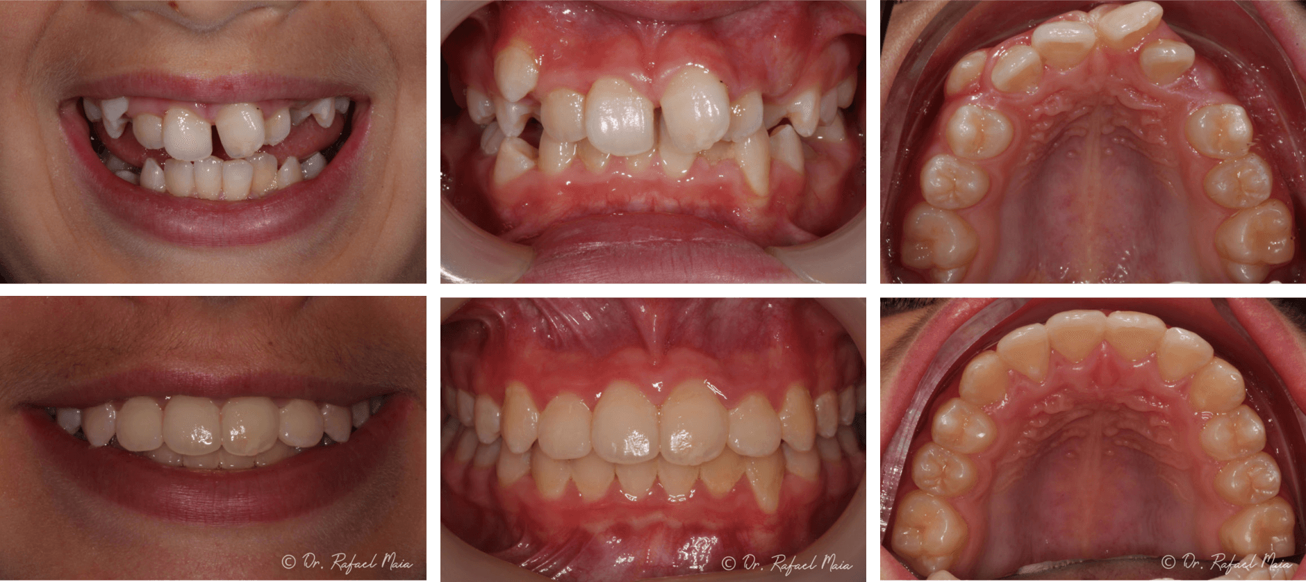 Casestudi1(1)