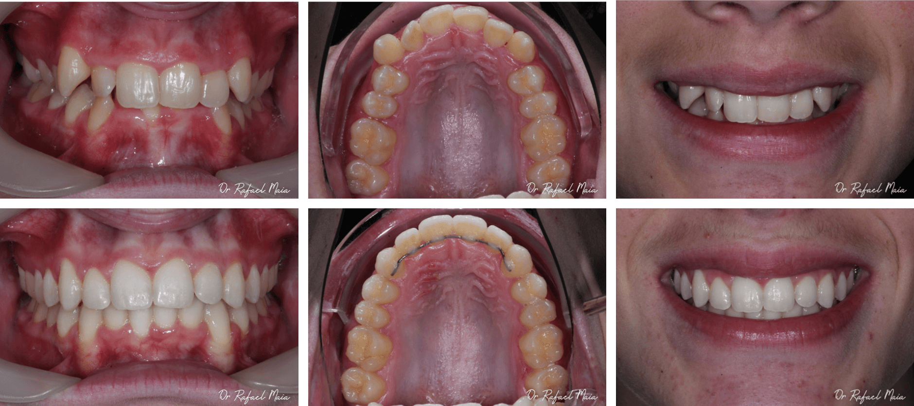 Casestudy11(1)